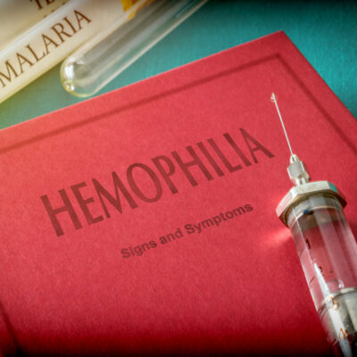 Prevent the Risk of Hemophilia by Following These Tips