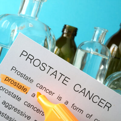 Prostate Cancer: Main Symptoms and Stages