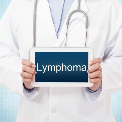 The Most Common Causes and Early Signs of Lymphoma