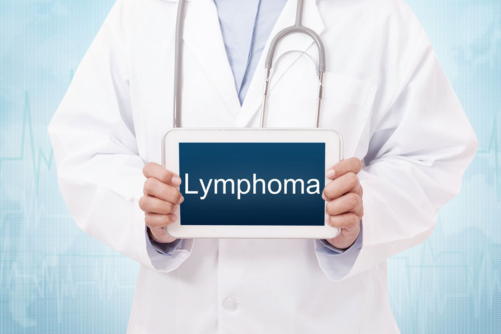 The Most Common Causes and Early Signs of Lymphoma