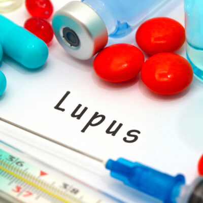 6 Common Lupus Signs