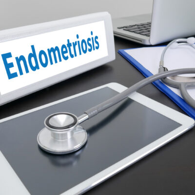 5 Early Signs of Endometriosis